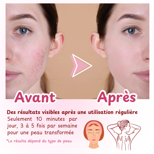 Appareil Beauté Gua Sha électrique 3-en-1